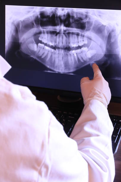 Best Emergency Tooth Extraction in Chevy Chase Heights, PA