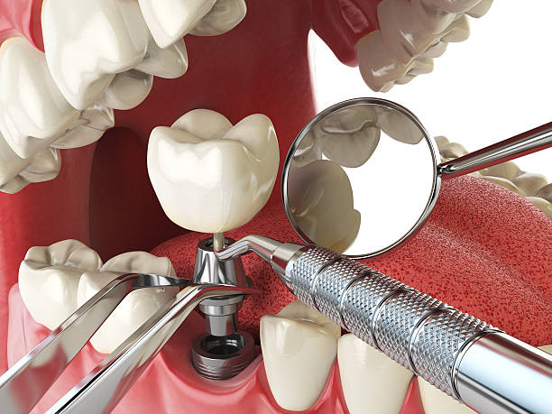 Best Emergency Gum Treatment in Chevy Chase Heights, PA